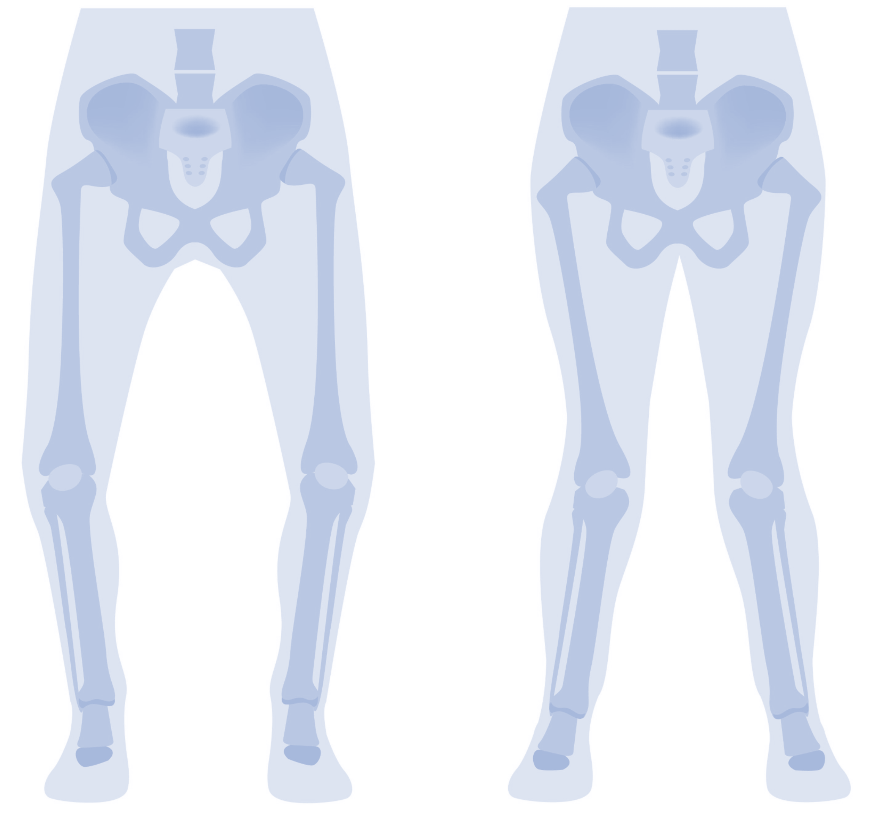 Informationsabend der Orthopädie: Beinfehlstellungen