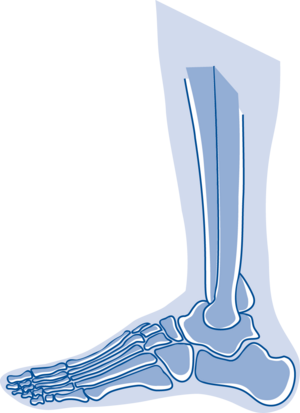 informationsabend der Orthopädie: Fußchirurgie